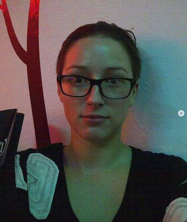 加拿大女網紅沉迷整形，結果胸給隆“炸”了，剩單側巨乳