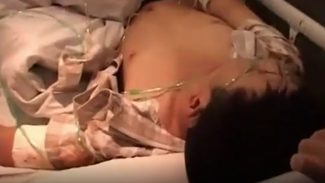 蘇州小伙被神秘毒蛇咬傷，為了救他全城出動，毒蛇到底有多恐怖