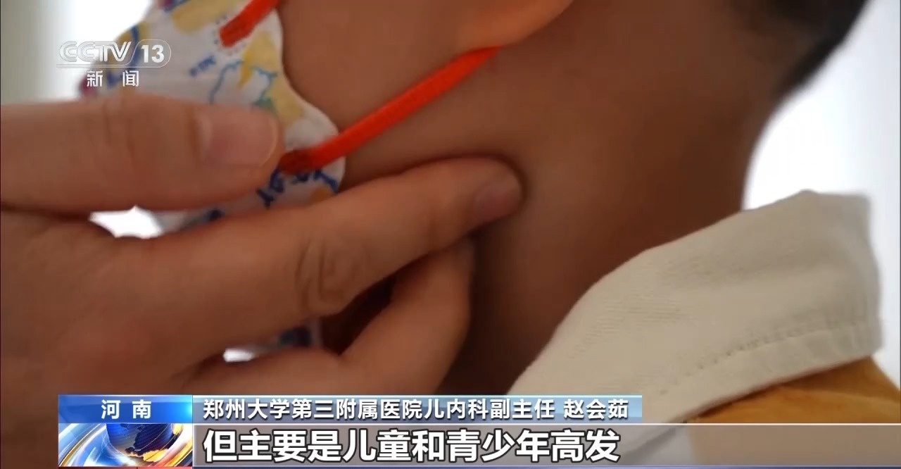 孩子不能又親又抱 當(dāng)心“親吻病”→