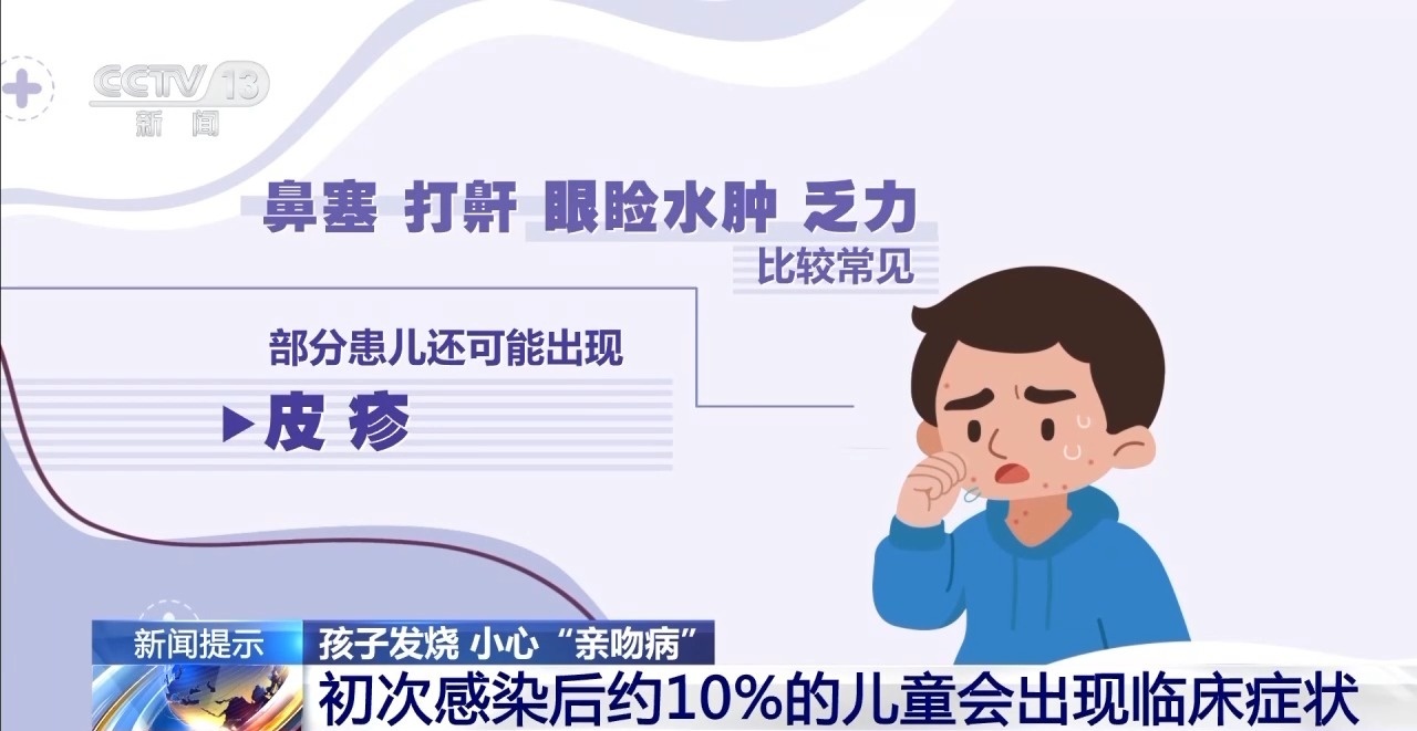 孩子不能又親又抱 當(dāng)心“親吻病”→
